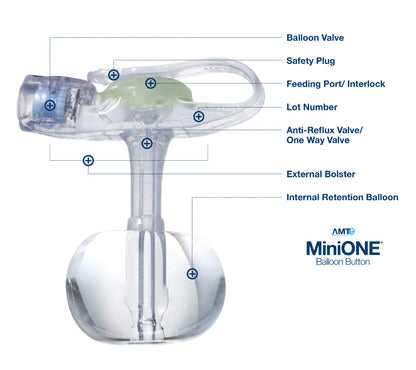 MiniONE® 16 Fr. 1.0 cm Tube Silicone Sterile Low Profile Balloon Button Gastrostomy Tube Kit